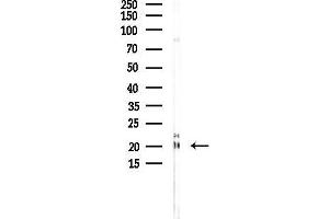Western blot analysis of lysates from Rat muscle, using Cofilin Antibody at 1/1000 dilution.