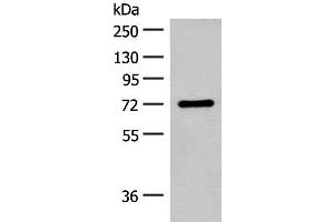 Western blot analysis of Rat brain tissue lysate using SLC6A11 Polyclonal Antibody at dilution of 1:500 (SLC6A11 Antikörper)