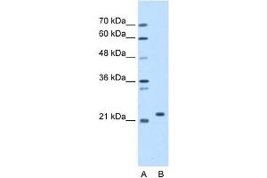 SDF2 antibody used at 1.