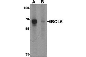 Western blot analysis of BCL6 in rat lung tissue lysate with Bcl6 Antibody  at 1 μg/ml in (A) the absence and (B) the presence of blocking peptide (BCL6 Antikörper  (Middle Region))