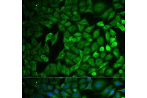 Immunofluorescence analysis of MCF-7 cells using FBXO11 Polyclonal Antibody