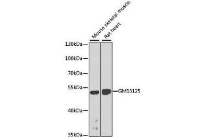 Western blot analysis of extracts of various cell lines, using Gm13125 antibody. (Pramel15 Antikörper  (AA 67-274))
