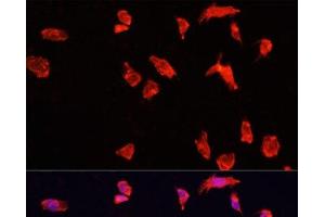 Immunofluorescence analysis of HeLa cells using ATP6V1B2 Polyclonal Antibody at dilution of 1:100. (ATP6V1B2 Antikörper)