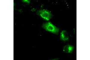 Image no. 3 for anti-Nucleotide Exchange Factor SIL1 (SIL1) antibody (ABIN1496810) (SIL1 Antikörper)