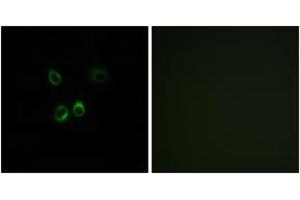 Immunofluorescence analysis of MCF7 cells, using RGR Antibody.