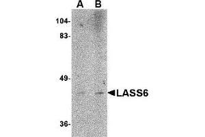 Western Blotting (WB) image for anti-Ceramide Synthase 6 (CERS6) (N-Term) antibody (ABIN1031437) (CERS6 Antikörper  (N-Term))