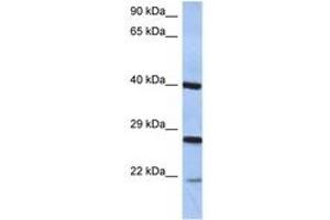 Image no. 1 for anti-Cell Death-Inducing DFFA-Like Effector B (CIDEB) (C-Term) antibody (ABIN6744363) (CIDEB Antikörper  (C-Term))