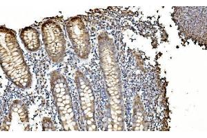 IHC analysis of LSM2 using anti-LSM2 antibody (ABIN7602832).