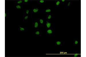 Immunofluorescence of monoclonal antibody to CSE1L on HeLa cell.