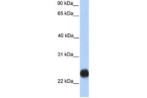 WB Suggested Anti-TMEM123 Antibody Titration:  0. (TMEM123 Antikörper  (C-Term))