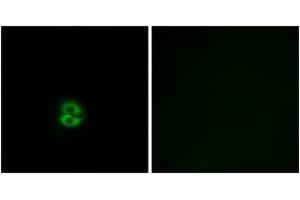 Immunofluorescence (IF) image for anti-Carbohydrate (N-Acetylglucosamine 6-O) Sulfotransferase 6 (CHST6) (AA 331-380) antibody (ABIN2890183) (CHST6 Antikörper  (AA 331-380))