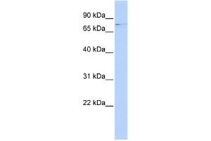 WB Suggested Anti-RRN3 Antibody Titration:  0. (RRN3 Antikörper  (Middle Region))