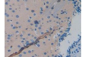 Detection of MAPT in Mouse Brain Tissue using Polyclonal Antibody to Tau Protein (MAPT) (tau Antikörper  (AA 92-400))
