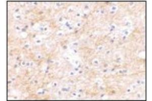 Immunohistochemical staining of human brain tissue using AP30751PU-N at 2. (DLGAP3 Antikörper  (C-Term))