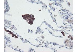Image no. 2 for anti-Snail Family Zinc Finger 2 (SNAI2) antibody (ABIN1500985) (SLUG Antikörper)