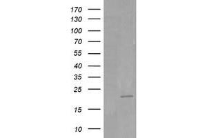 Image no. 4 for anti-HRas proto-oncogene, GTPase (HRAS) antibody (ABIN1498715) (HRAS Antikörper)