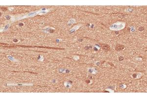 Immunohistochemical staining of human cerebral cortex tissue using anti-Beta Tubulin antibody. (Rekombinanter TUBB Antikörper)