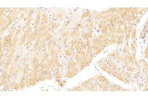 Detection of vWF in Rat Heart Tissue using Polyclonal Antibody to Von Willebrand Factor (vWF) (VWF Antikörper  (AA 49-230))