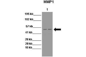 Western Blotting (WB) image for anti-Matrix Metallopeptidase 1 (Interstitial Collagenase) (MMP1) (N-Term) antibody (ABIN2777119)