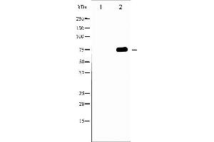 Western blot analysis of Tau phosphorylation expression in MDA-MB-435 whole cell lysates,The lane on the left is treated with the antigen-specific peptide. (MAPT Antikörper  (pThr231))