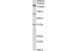 ABIN2561978 (1µg/ml) staining of Human Testis lysate (35µg protein in RIPA buffer). (CP110 Antikörper  (N-Term))