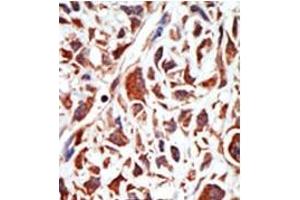 Image no. 2 for anti-BMI1 Polycomb Ring Finger Oncogene (BMI1) (C-Term) antibody (ABIN357748) (BMI1 Antikörper  (C-Term))