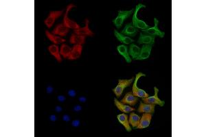 Phospho-GRK2 (Ser670) Antibody staining Hela cells(heat shock treatment) by IF/ICC. (GRK2 Antikörper  (pSer670))