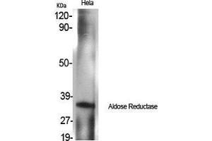 Western Blot (WB) analysis of specific cells using Aldose Reductase Polyclonal Antibody. (AKR1B1 Antikörper  (C-Term))
