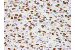 Immunohistochemistry (IHC) image for anti-Heterogeneous Nuclear Ribonucleoprotein H1 (H) (HNRNPH1) (C-Term) antibody (ABIN7448597) (HNRNPH1 Antikörper  (C-Term))