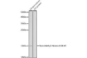 Western blot analysis of extracts of C6 cells, using MonoMethyl-Histone H2B-K5 antibody (ABIN7267735) at 1:500 dilution.