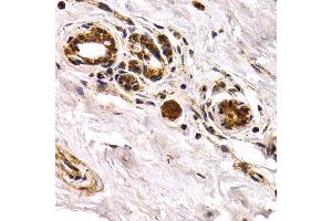 Immunohistochemistry of paraffin-embedded human normal breast using CHI3L1 antibody at dilution of 1:200 (400x lens).