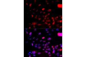 Immunofluorescence analysis of U2OS cells using Phospho-CHEK1-S317 antibody (ABIN5969879). (CHEK1 Antikörper  (pSer317))