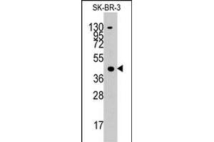 Western blot analysis of ACAT1 polyclonal antibody  in SK-BR-3 cell line lysates (35 ug/lane). (ACAT1 Antikörper  (C-Term))