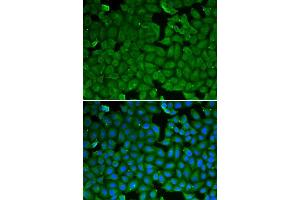 Immunofluorescence (IF) image for anti-serine Peptidase Inhibitor, Kazal Type 1 (SPINK1) (AA 24-79) antibody (ABIN6215027) (SPINK1 Antikörper  (AA 24-79))