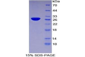 SDS-PAGE analysis of Human TFPI2 Protein. (TFPI2 Protein)