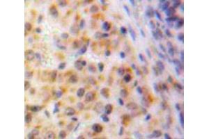 Used in DAB staining on fromalin fixed paraffin-embedded Ovary tissue (EGR1 Antikörper  (AA 282-433))