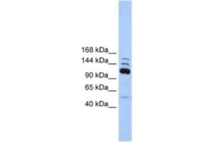 Western Blotting (WB) image for anti-Polymerase (RNA) III (DNA Directed) Polypeptide B (POLR3B) antibody (ABIN2463219)