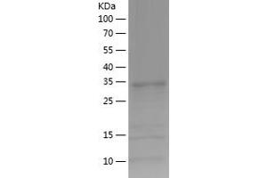 ADO Protein (AA 49-261) (His tag)