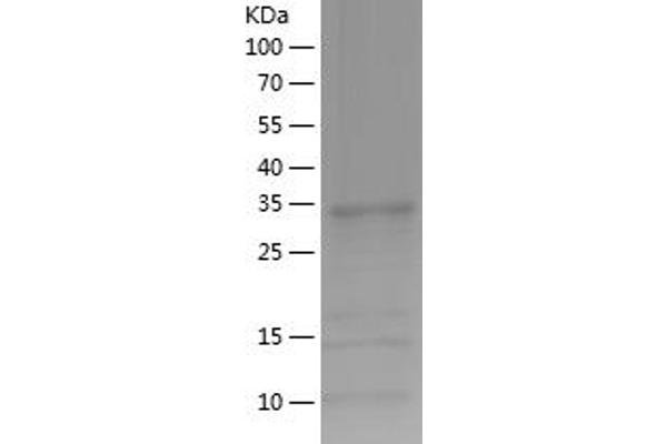 ADO Protein (AA 49-261) (His tag)