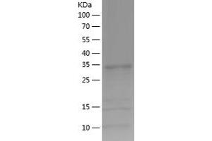 Western Blotting (WB) image for 2-Aminoethanethiol (Cysteamine) Dioxygenase (ADO) (AA 49-261) protein (His tag) (ABIN7121600) (ADO Protein (AA 49-261) (His tag))