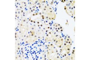 Immunohistochemistry of paraffin-embedded mouse kidney using SET/T antibody (ABIN6131353, ABIN6147631, ABIN6147634 and ABIN6221803) at dilution of 1:100 (40x lens). (SET/TAF-I Antikörper  (AA 1-277))