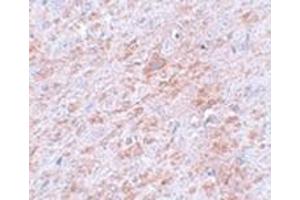 Immunohistochemistry of DLCK2 in rat brain tissue with DLCK2 antibody at 5 μg/ml. (DCLK2 Antikörper  (C-Term))