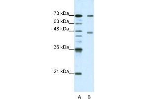 WB Suggested Anti-PABPC4 Antibody Titration:  1. (PABPC4 Antikörper  (N-Term))