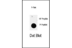 Dot blot analysis of anti-Phospho-ANTXR1-p Antibody (ABIN389986 and ABIN2839770) on nitrocellulose membrane. (ANTXR1 Antikörper  (pTyr425))