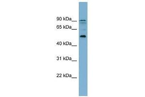 ZNF662 antibody used at 0. (ZNF662 Antikörper  (Middle Region))