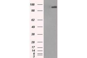 Image no. 1 for anti-L1 Cell Adhesion Molecule (L1CAM) antibody (ABIN1499083)