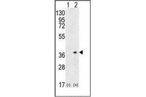 Western blot analysis of HLA-DQA1 (arrow) using HLA-DQA1 Antibody (N-term) Cat.