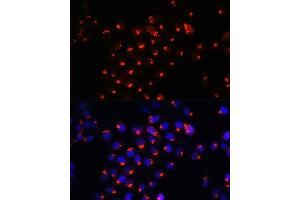 Immunofluorescence analysis of HeLa cells using SGMS1 Rabbit pAb (ABIN7270532) at dilution of 1:100. (Sphingomyelin Synthase 1 Antikörper  (AA 1-134))