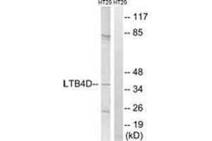 Western blot analysis of extracts from HT-29 cells, using PTGR1 Antibody. (PTGR1 Antikörper  (AA 75-124))