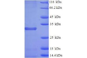 SDS-PAGE (SDS) image for Baculoviral IAP Repeat-Containing 5 (BIRC5) (AA 1-140), (full length) protein (His-SUMO Tag) (ABIN5709139)